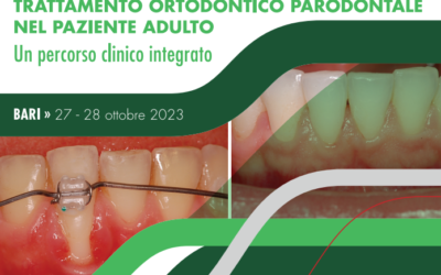 Trattamento Ortondotico Parodontale nel paziente adulto: corso a Bari